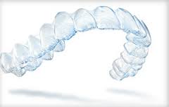 Los-Angeles-Orthodontist-Invisalign