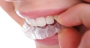 braces-orthodontist