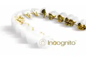 Invisible braces for teeth alignment