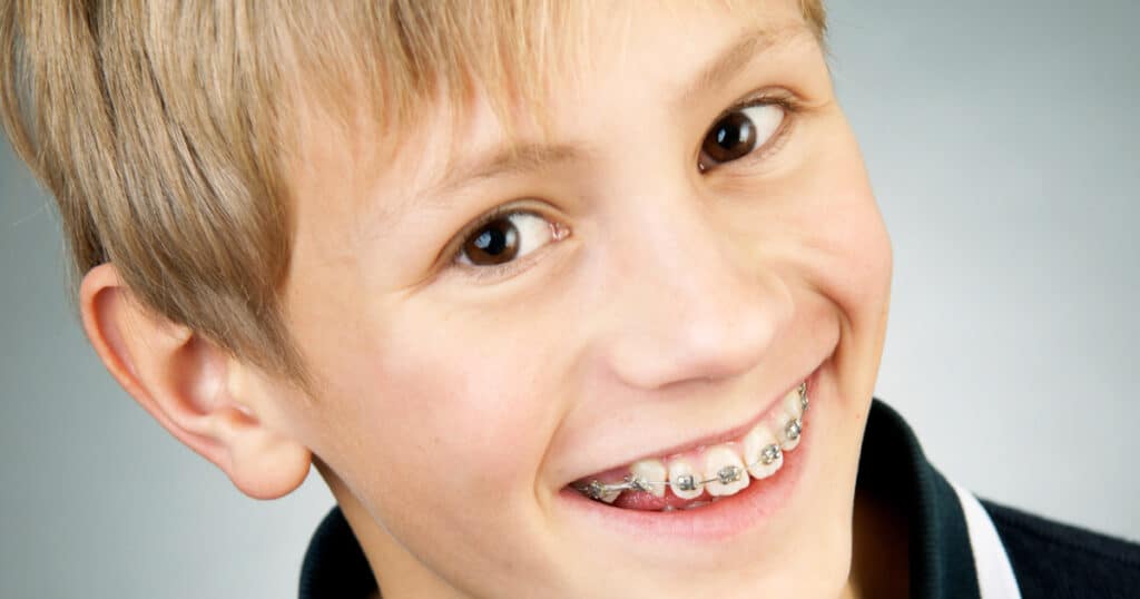 Smiling boy with braces on teeth