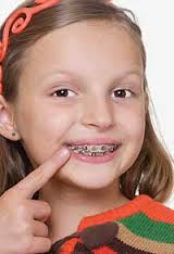 Century City, CA Orthodontist Offers Braces for Children 5 Girl-on-Hammock