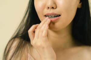 upclose of girl wearing braces