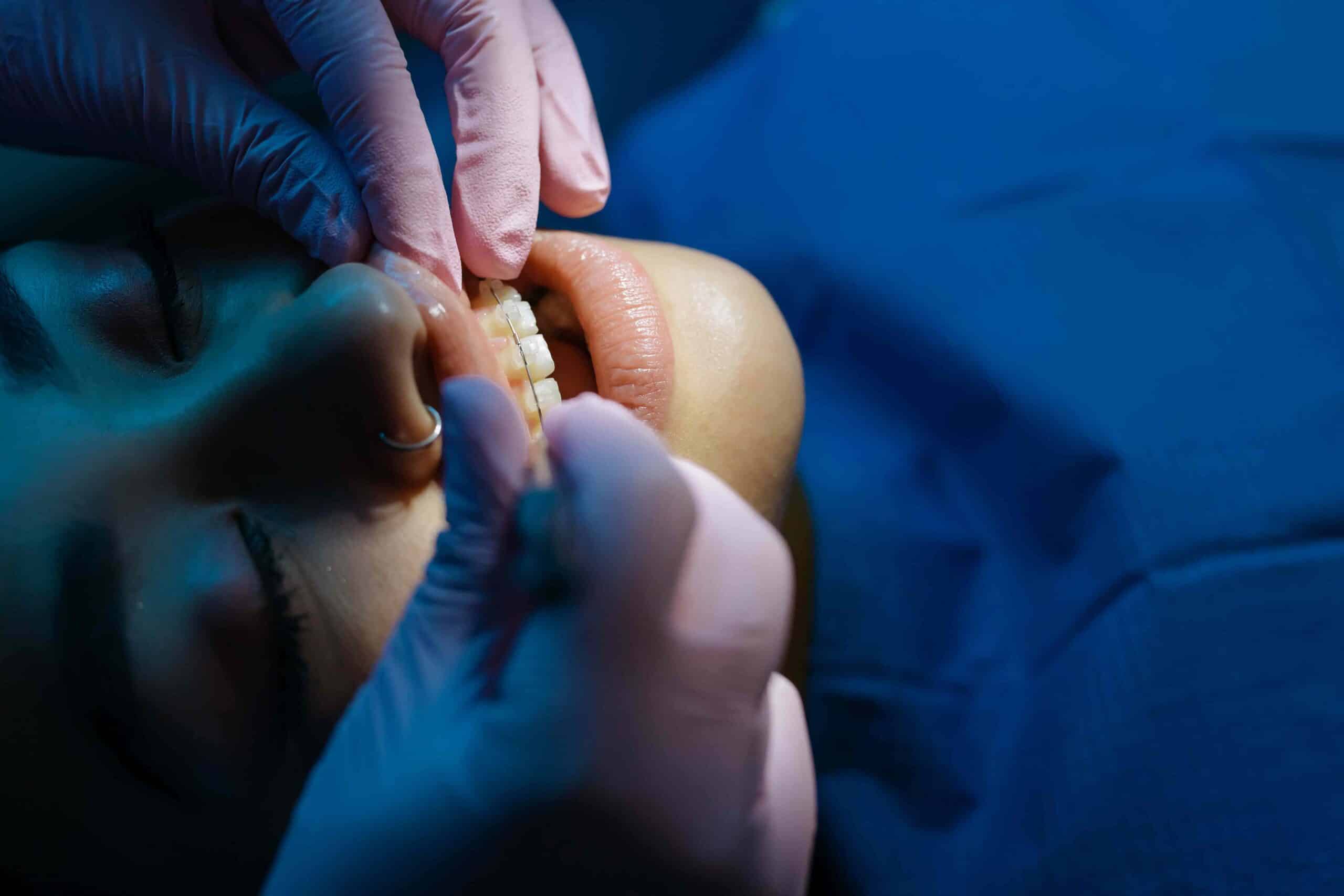 patient getting orthodontic treatment